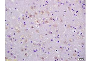 Formalin-fixed and paraffin embedded rat brain labeled with Anti-phospho-P53(Ser20) Polyclonal Antibody, Unconjugated (ABIN702895) at 1:200 followed by conjugation to the secondary antibody and DAB staining. (p53 antibody  (pSer20))