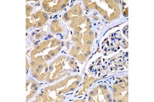 Immunohistochemistry of paraffin-embedded human kidney using WIPI2 antibody at dilution of 1:100 (x400 lens). (WIPI2 antibody)