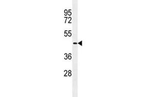 TMPRSS11E2 antibody western blot analysis in NCI-H292 lysate. (TMPRSS11E antibody  (AA 249-277))