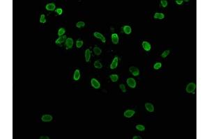 Immunofluorescence staining of Hela cells with ABIN7139179 at 1:37. (HIST1H3A antibody  (acLys36))