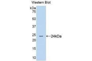 Detection of Recombinant AGR2, Human using Monoclonal Antibody to Anterior Gradient 2 (AGR2) (AGR2 antibody  (AA 21-175))