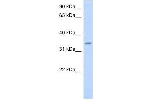 PAQR6 antibody used at 1 ug/ml to detect target protein. (PAQR6 antibody  (Middle Region))