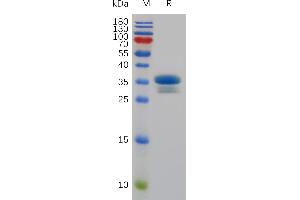 Mouse TweakR Protein, hFc Tag on SDS-PAGE under reducing condition. (TNFRSF12A Protein (AA 28-78) (Fc Tag))