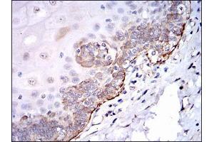 Immunohistochemistry (IHC) image for anti-Proto-oncogene tyrosine-protein kinase Src (Src) antibody (ABIN969418)