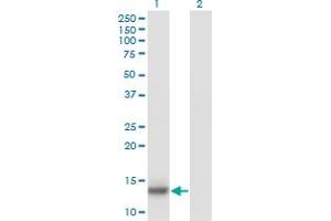 Western Blot analysis of IL2 expression in transfected 293T cell line by IL2 monoclonal antibody (M11), clone 1C5. (IL-2 antibody  (AA 21-153))