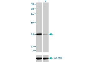 Western blot analysis of TNNI3 over-expressed 293 cell line, cotransfected with TNNI3 Validated Chimera RNAi (Lane 2) or non-transfected control (Lane 1). (TNNI3 antibody  (AA 102-210))
