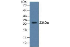 Western Blotting (WB) image for Gremlin 1 (GREM1) ELISA Kit (ABIN6730963)