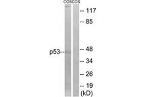 Western Blotting (WB) image for anti-Tumor Protein P53 (TP53) (AA 8-57) antibody (ABIN2889048) (p53 antibody  (AA 8-57))