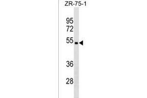 CHST5 Antibody (C-term) (ABIN1536997 and ABIN2850338) western blot analysis in ZR-75-1 cell line lysates (35 μg/lane). (CHST5 antibody  (C-Term))
