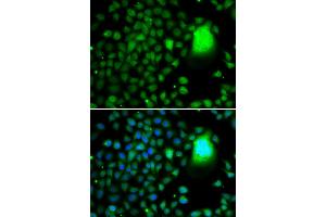 Immunofluorescence analysis of MCF-7 cells using TAF5 antibody (ABIN5974349). (TAF5 antibody)
