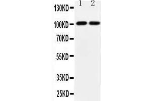 Anti-GRIA3 antibody, All Western blottingAll lanes: Anti-GRIA3  at 0. (Glutamate Receptor 3 antibody  (Middle Region))