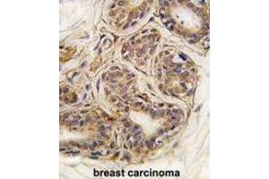 Immunohistochemistry (IHC) image for anti-Cancer Susceptibility Candidate 3 (CASC3) antibody (ABIN2995203) (CASC3 antibody)