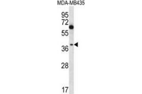 NFKBIL1 antibody  (C-Term)