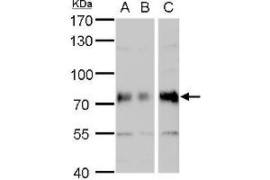 WB Image DMPK antibody detects DMPK protein by western blot analysis. (DMPK antibody  (Center))