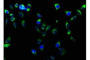 Immunofluorescence (IF) image for anti-Integrin beta 1 (ITGB1) antibody (ABIN7127584)