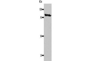 Western Blotting (WB) image for anti-Dynamin 1 (DNM1) antibody (ABIN2431272) (Dynamin 1 antibody)