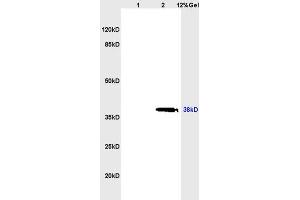 SDS-PAGE (SDS) image for anti-Selectin L (SELL) (AA 301-372) antibody (ABIN736716)