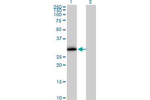 Western Blot analysis of VAPA expression in transfected 293T cell line by VAPA MaxPab polyclonal antibody. (VAPA antibody  (AA 1-242))