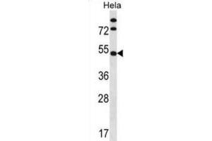 Western Blotting (WB) image for anti-Inositol Hexakisphosphate Kinase 1 (IP6K1) antibody (ABIN2998737) (IP6K1 antibody)