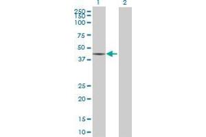 Lane 1: NARG2 transfected lysate ( 36. (NARG2 293T Cell Transient Overexpression Lysate(Denatured))