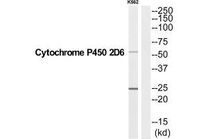 Western Blotting (WB) image for anti-Cytochrome P450, Family 2, Subfamily D, Polypeptide 6 (CYP2D6) (C-Term) antibody (ABIN1852640) (CYP2D6 antibody  (C-Term))