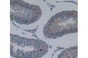 Used in DAB staining on fromalin fixed paraffin- embedded Kidney tissue (SPA17 antibody  (AA 1-140))
