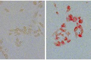 Human pancreatic carcinoma cell line MIA PaCa-2 was stained with Mouse Anti-Human EGFR-UNLB. (EGFR antibody)
