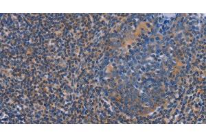 Immunohistochemistry of paraffin-embedded Human tonsil using AGFG1 Polyclonal Antibody at dilution of 1:60 (AGFG1 antibody)