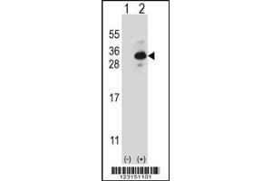 Western blot analysis of CLTB using rabbit polyclonal CLTB Antibody using 293 cell lysates (2 ug/lane) either nontransfected (Lane 1) or transiently transfected (Lane 2) with the CLTB gene. (CLTB antibody)