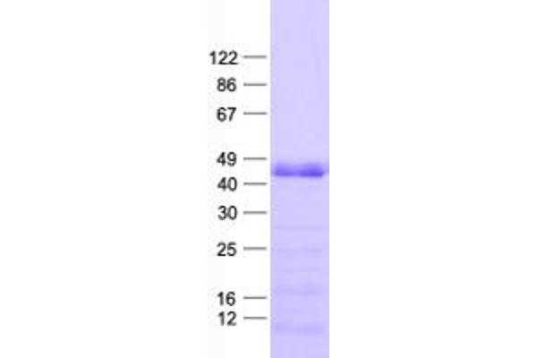 PHF6 Protein (His tag)