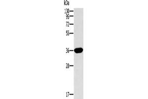 Gel: 10 % SDS-PAGE, Lysate: 40 μg, Lane: Human fetal intestine tissue, Primary antibody: ABIN7129939(ITLN1 Antibody) at dilution 1/400, Secondary antibody: Goat anti rabbit IgG at 1/8000 dilution, Exposure time: 2 minutes (ITLN1/Omentin antibody)