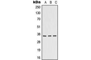 Western blot analysis of Heme Oxygenase 2 expression in HeLa (A), HepG2 (B), Raw264. (HMOX2 antibody  (N-Term))