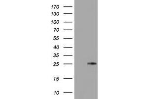 HEK293T cells were transfected with the pCMV6-ENTRY control (Left lane) or pCMV6-ENTRY TIMP2 (Right lane) cDNA for 48 hrs and lysed. (TIMP2 antibody)