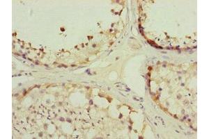 Immunohistochemistry of paraffin-embedded human testis tissue using ABIN7159918 at dilution of 1:100 (TOMM34 antibody  (AA 1-309))