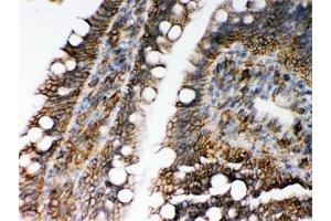 IHC testing of FFPE rat intestine with HLA-C antibody. (HLA-C antibody)