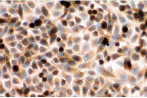 Anti-Cytochrome P450 Reductase antibody, ICC ICC: HELA Cell (POR antibody  (C-Term))