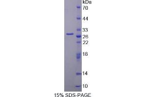 Image no. 1 for phosphoprotein Associated with Glycosphingolipid Microdomains 1 (PAG1) (AA 138-357) protein (His tag) (ABIN4990573) (PAG1 Protein (AA 138-357) (His tag))