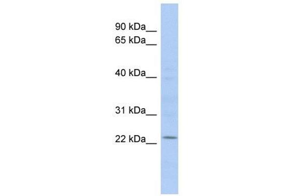 UBE2E1 antibody