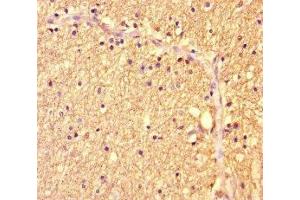 Immunohistochemistry of paraffin-embedded human brain tissue using ABIN7175986 at dilution of 1:100 (ZBTB46 antibody  (AA 174-362))