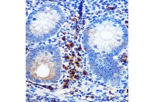 Immunohistochemistry of paraffin-embedded human appendix using CD41/ITGB Rabbit mAb (ABIN7267925) at dilution of 1:100 (40x lens). (Integrin Alpha2b antibody)