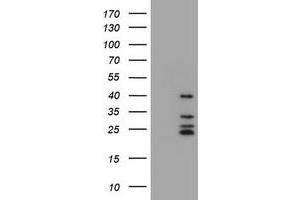 Image no. 2 for anti-Membrane-Spanning 4-Domains, Subfamily A, Member 1 (MS4A1) antibody (ABIN1497205) (CD20 antibody)