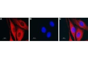 Expression of Aquaporin 4 in rat glioma C6 cells - Immunocytochemical staining of fixed and permeabilized rat glioma C6 cells. (Aquaporin 4 antibody  (C-Term, Intracellular))