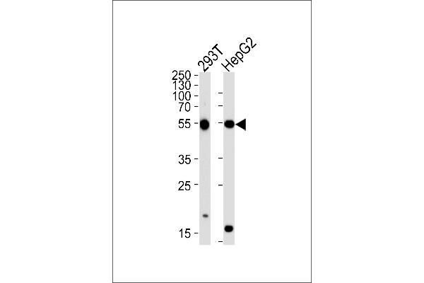 PHKG1 antibody