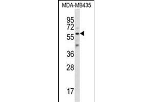 Fascin 3 antibody  (C-Term)