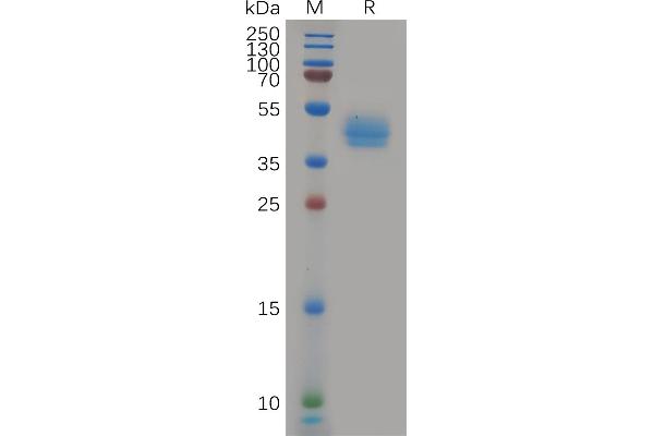 CCR7 Protein (AA 25-59) (Fc Tag)