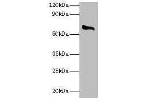 Western blot All lanes: CYP11A1 antibody at 2 μg/mL + Rat adrenal gland tissue Secondary Goat polyclonal to rabbit IgG at 1/10000 dilution Predicted band size: 61, 43 kDa Observed band size: 61 kDa (CYP11A1 antibody  (AA 40-521))