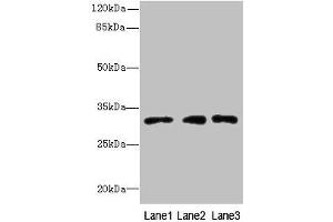 Western blot All lanes: PRDX4 antibody at 8 μg/mL Lane 1: HepG2 whole cell lysate Lane 2: Hela whole cell lysate Lane 3: 293T whole cell lysate Secondary Goat polyclonal to rabbit IgG at 1/10000 dilution Predicted band size: 31 kDa Observed band size: 31 kDa (Peroxiredoxin 4 antibody  (AA 38-271))