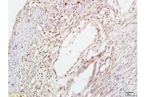 Formalin-fixed and paraffin embedded mouse uterus labeled with Anti-Smad3 (Ser423 + Ser425) Polyclonal Antibody, Unconjugated  at 1:200 followed by conjugation to the secondary antibody and DAB staining (SMAD3 antibody  (pSer423, pSer425))