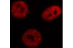ABIN6269111 staining Hep G2 cells by IF/ICC. (HNRNPC antibody  (C-Term))