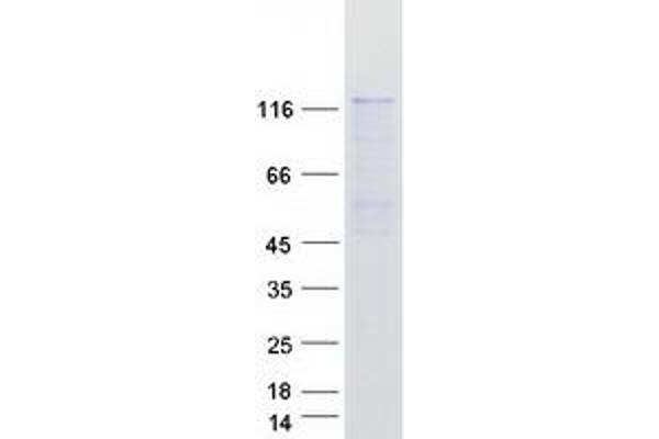 SMC6 Protein (Transcript Variant 2) (Myc-DYKDDDDK Tag)